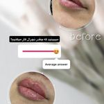 کلینیک زیبایی لاغری لیزر دانا