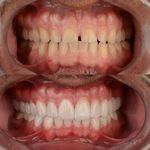 کلینیک دندان پزشکی دنو - بیمه نداریم