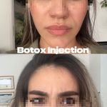 مطب زیبایی آرا