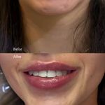 مطب زیبایی آرا