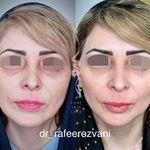 مرکز تخصصی لیزر و زیبایی و لاغری پیور