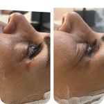 جوانسازی و فیشال پوست خدارحمی