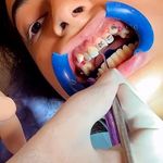 مرکز ارتودنسی غرب  سعادت آباد