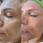 درمانگر پوست زهره مهرابی