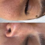 خدمات تخصصی پوست،فیشال،ماساژ سندی بانوان