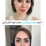 کلینیک تخصصی پوست و زیبایی ملینا