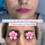 مرکز لیزر و کلینیک زیبایی پریفا