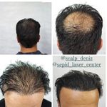 مرکز تخصصی میکرو اسکالپ