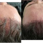 مرکز تخصصی میکرو اسکالپ