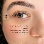 لیفت‌تخصصی‌مژه‌ و ابرو سمانه‌شاطرزاده