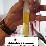 کلینیک هانیل | فیلر بوتاکس آنی‌لیفت شرق
