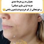 کلینیک هانیل | فیلر و بوتاکس شرق