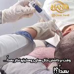 کلینیک هانیل | فیلر و بوتاکس شرق