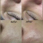 آموزش و خدمات پوست و فیشال رویا باقریان