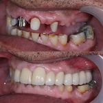 دنداپزشکی دکتر یاشار معزز