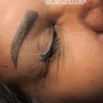 مرکز لیزر و هایفو مختاری