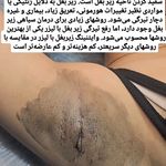 مرکز لیزر و هایفو مختاری