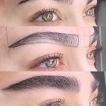 مرکز میکروبلیدینگ وفیبروز فرشته تقی زاده