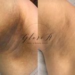 کلینیک زیبایی گلوریا