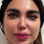 مطب پوست مو زیبایی و لاغری ژن شیک