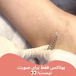 مرکز لیزر ،پوست و زیبایی کندی بیوتی