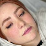 مرکز لیزر ،پوست و زیبایی کندی بیوتی