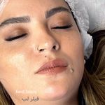 مرکز لیزر ،پوست و زیبایی کندی بیوتی