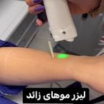 مرکز لیزر ،پوست و زیبایی کندی بیوتی