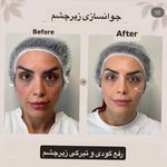 مرکز لیزر ،پوست و زیبایی کندی بیوتی