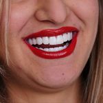 خدمات دندانپزشکی دکتر زهرا خلیلی