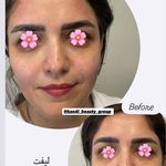 مرکز لیزر ،پوست و زیبایی کندی بیوتی