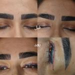 کلینیک زیبایی بهسا