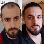 کلینیک زیبایی آوان |