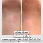 کلینیک پوست و مو و لیزر نیلوفر آبی