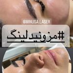 کلینیک لیزر و زیبایی مهسان