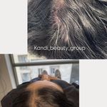مرکز لیزر ،پوست و زیبایی کندی بیوتی