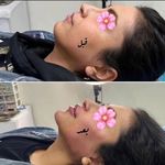 فیشال درمانی و پاکسازی پوست میرجلیلی