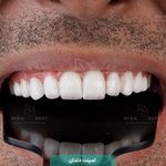 کلینیک دندانپزشکی دیان