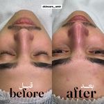 سالن تخصصی کوتاهی مو و فیشیال امیربارویی