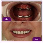 کلینیک دندانپزشکی تخصصی ایثار مشیریه