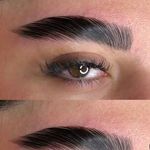 لیفت ابرو آیدا عزیزی