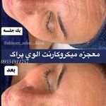 فیشال درمانی و جوانسازی سحرجدیدی