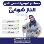 ناخن کده اِل - الناز شهابی