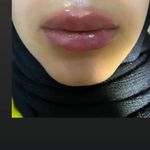 کلینیک لیزر،پوست،مو،زیبایی