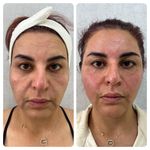 کلینیک زیبایی هانا