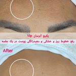 خدمات تخصصی فیشال