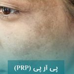 کلینیک پوست و مو هورسام