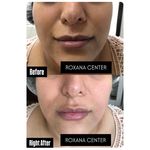 کلینیک پوست مو و زیبایی رکسانا