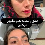 کلینیک ژل بوتاکس لیزر فیل بیوتی