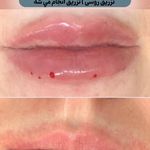 كلينيك زيبايي پوستينو